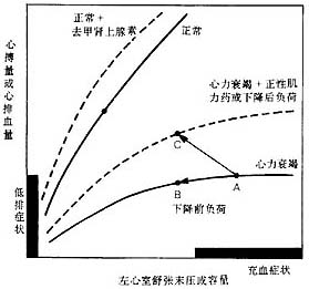 慢性心功能不全