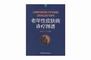 老年性皮膚病診療圖譜 老年性皮膚病診療圖譜