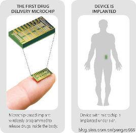 晶片醫生 晶片醫生