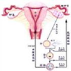 （圖）試管嬰兒與原理