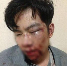 11.25泰國明星保鏢酒吧打人事件 11.25泰國明星保鏢酒吧打人事件