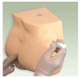 肌注部位 肌注部位