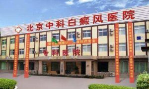 北京中科白癜風醫院