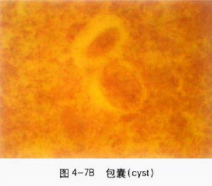 藍氏賈第鞭毛蟲