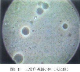 卵磷脂小體 卵磷脂小體