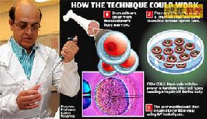 人造精子 人造精子