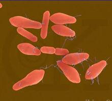 肉毒梭狀芽孢桿菌 肉毒梭狀芽孢桿菌