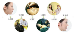 黃金三角美鼻微雕術