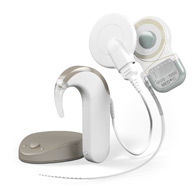 聽覺植入 聽覺植入