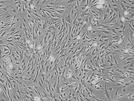 骨髓乾抽 骨髓乾抽