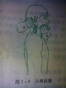 頸椎分離試驗 頸椎分離試驗