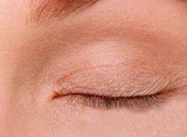 眼張不開 眼張不開