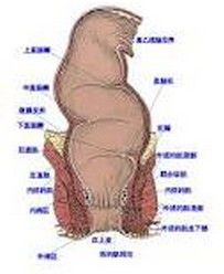 肛門直腸淋病 肛門直腸淋病
