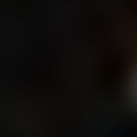 IC 4311 RASS 彩色圖