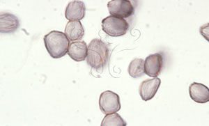 圖說： 匍枝根霉孢
