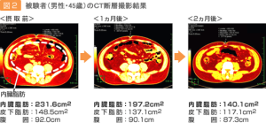 圖3-1 實驗對象（男性・45歲）的CT斷層影像結果