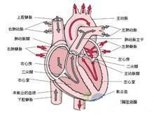 心肌梗死后綜合征 心肌梗死后綜合征