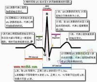 心電圖U波 心電圖U波