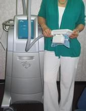 冷凍減肥術 冷凍減肥術