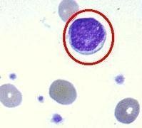 巨核細胞 巨核細胞