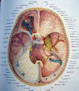 海綿竇血栓 海綿竇血栓