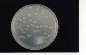 矽酸鹽細菌