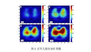 動態電阻抗斷層成像 動態電阻抗斷層成像