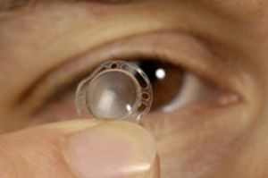 人工眼角膜 人工眼角膜