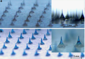 （2009年）第二代無影針電子影像圖400μm