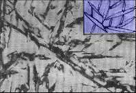 片狀馬氏體 片狀馬氏體