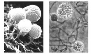 假普通鏈孢囊菌
