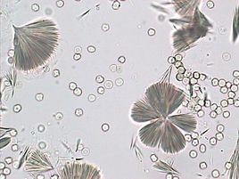 磺胺結晶 磺胺結晶