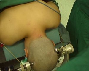 意識障礙的治療