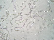 細胞排列呈念珠狀