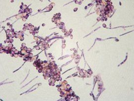 假絲酵母菌 假絲酵母菌