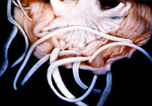 寄生在豬腸道內