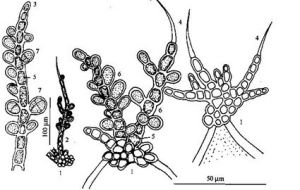 頂生頂絲藻 頂生頂絲藻