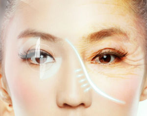 四維專利無痕祛眼袋 四維專利無痕祛眼袋