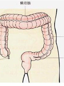 慢性結腸炎 慢性結腸炎