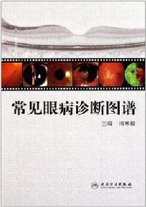 常見眼病診斷圖譜 常見眼病診斷圖譜