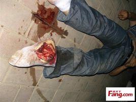 挑斷腳筋自殺 挑斷腳筋自殺