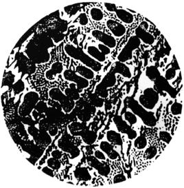 共晶滲碳體 共晶滲碳體