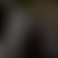 IC 2039 RASS 彩色圖