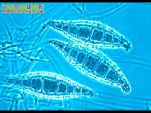 犬小孢子菌大分生孢子