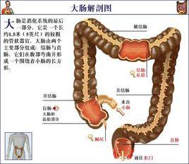 結腸潰瘍