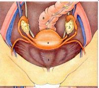 卵巢黃素囊腫
