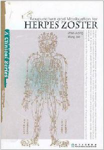 針灸治療帶狀皰疹 針灸治療帶狀皰疹
