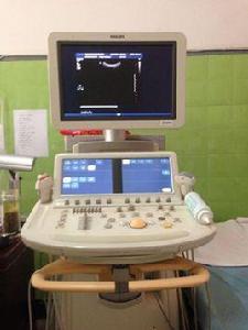 彩色都卜勒超聲心動圖 彩色都卜勒超聲心動圖