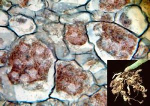 甘藍根腫菌 甘藍根腫菌