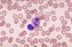 嗜酸性小體 嗜酸性小體